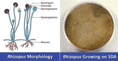 Rhizopus spp- An Overview