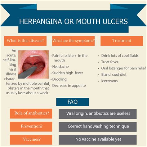 Herpangina or Painful Mouth Ulcers - Nathani Clinic