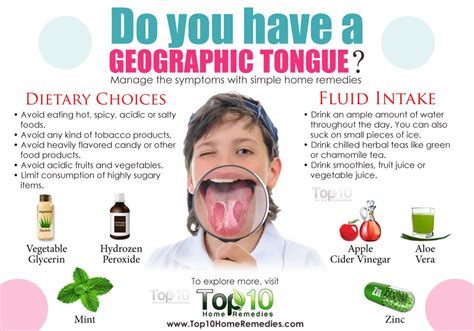 Home Remedies for Geographic Tongue | Top 10 Home Remedies