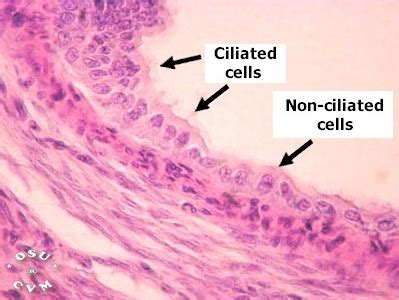 Oviduct Histology - Oviduct (labels) - histology slide