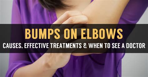 Bumps On Elbows Causes And Prevention Tips - vrogue.co