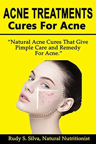 Acne Treatments: Cures For Acne: Natural acne cures That Give Pimple ...