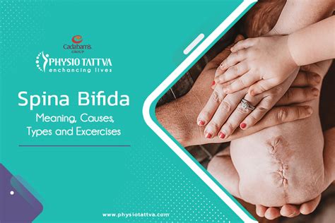 Spina Bifida : Symptoms, Causes, Diagnosis and Treatment