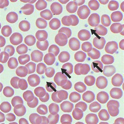 Platelets Microscope