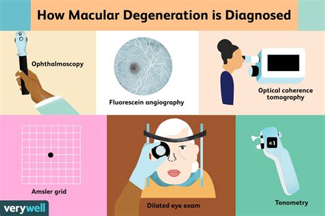 Macular Degeneration Tests and Exams for Diagnosis