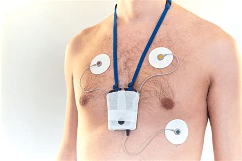 ECG Patch & Holter Monitor Market Size, Share, Growth Anlysis by 2029