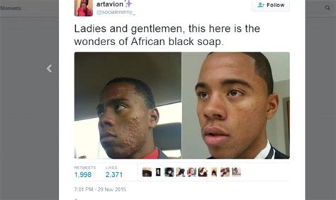 african black soap acne before & after | African black soap acne, African black soap, Black soap