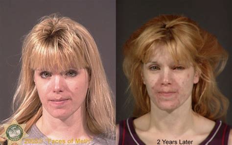 Meth Addicts: Before and After (38 pics) - Izismile.com