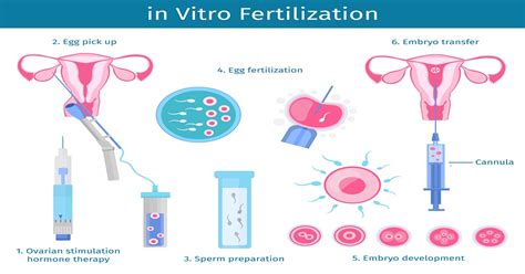 IVF Treatment Procedure Step By Step | Dr Mona Dahiya