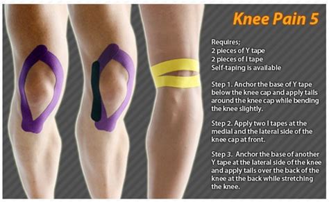 Pin on Kinesiology Tape: Ares