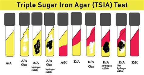 Triple Sugar Iron Agar