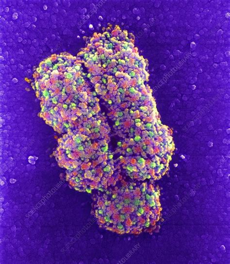 Chromosome, SEM - Stock Image - P656/0223 - Science Photo Library