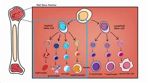 Leukemia - Overview - YouTube