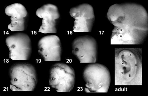 File:External ear stages-14-23-adult.jpg - Embryology