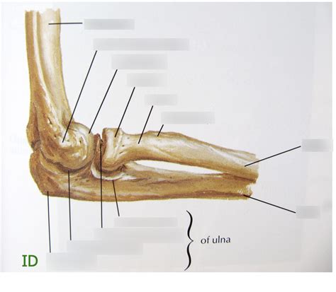 The Elbow - Hinge joint Diagram | Quizlet