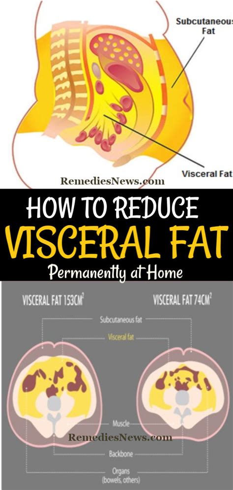 How to Lose Visceral Fat: Apply these 11 Weight Loss Tips to Burn Belly Fat