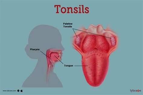 Tonsils (Human Anatomy): Image, Definition, Location, and Problems