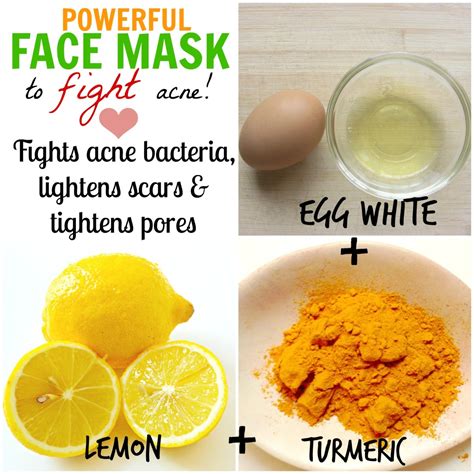 DIY Homemade Face Masks for Acne (How to Stop Pimples Naturally ...