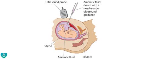 Mercy Perinatal