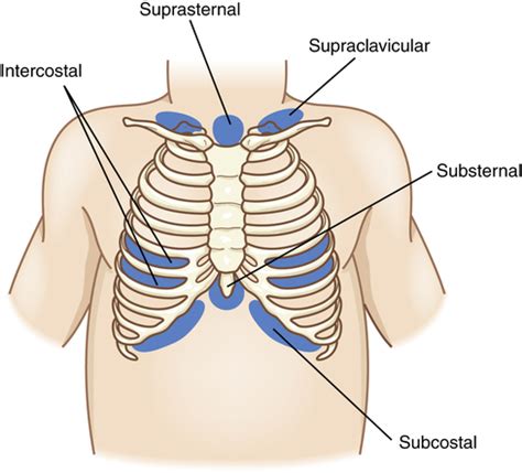 Alterations of Pulmonary Function in Children | Basicmedical Key