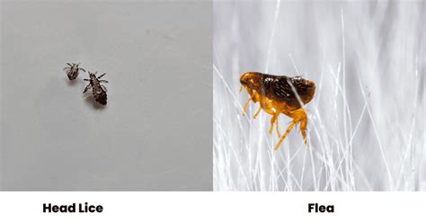 Difference Between Lice And Fleas