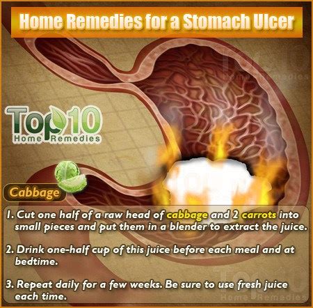 Home Remedies for a Stomach Ulcer ~ Mzizi Mkavu