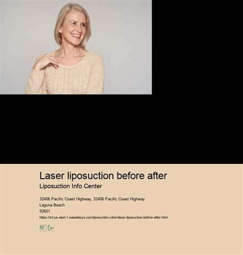 laser liposuction before after