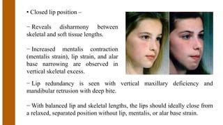 Orthodontic diagnosis | PPT