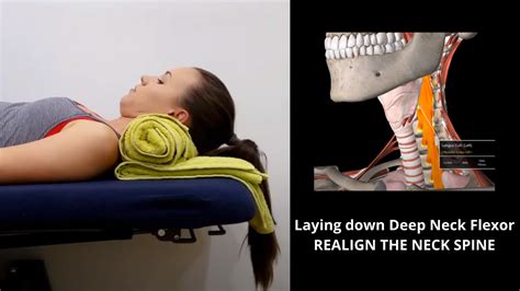 Laying down Deep Neck Flexor — Sydney Health Physiotherapy