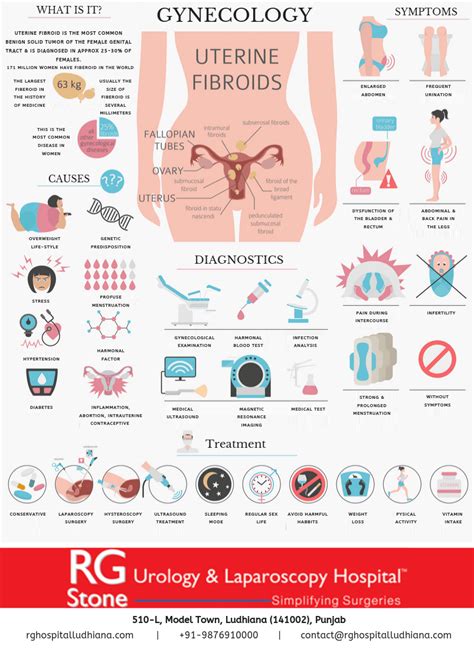 Gynecology - Uterine Fibroids Symptoms, Causes & Diagnostics | RG Stone ...