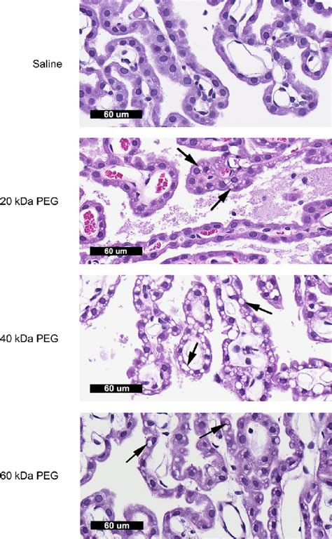 The choroid plexuses from a saline control rat and rats administered ...