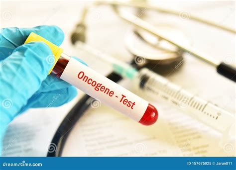 Blood Sample for Oncogene Test Stock Image - Image of chromosome, ca15: 157675025