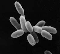 RachelYScientist2: Archaebacteria - Halobacterium salinarum