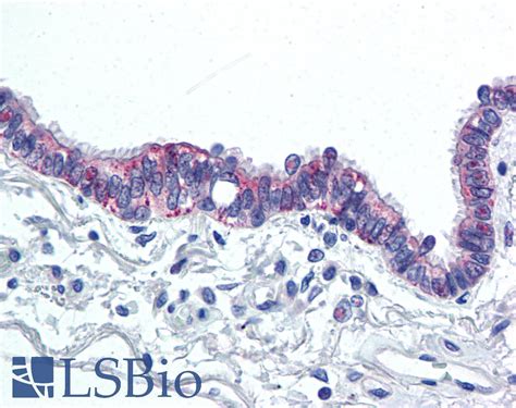 PathPlus™ IL6 / Interleukin 6 Polyclonal Antibody Rabbit IHC | LSBio