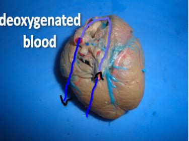 Deoxygenated blood to the heart - SignWiki