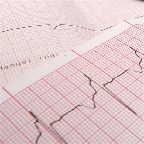 ECG Paper 101: Everything You Need to Know About ECG Paper | Panda Paper Roll