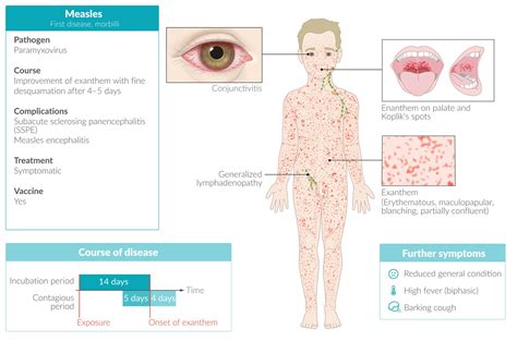 Rubella Vs Rubeola Rash