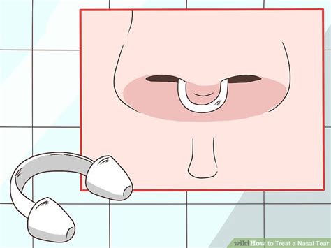 3 Ways to Treat a Nasal Tear - wikiHow