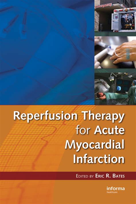 Reperfusion Therapy for Acute Myocardial Infarction | Taylor & Francis ...