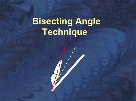 radio-graphic-techniques-bisecting-and-occlusal