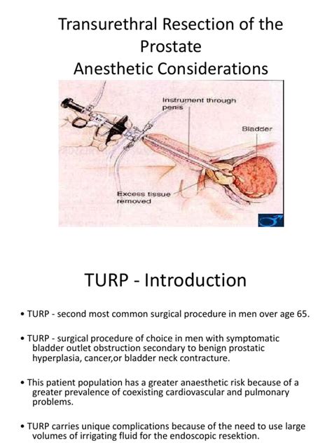 TURP | Medical Specialties | Clinical Medicine