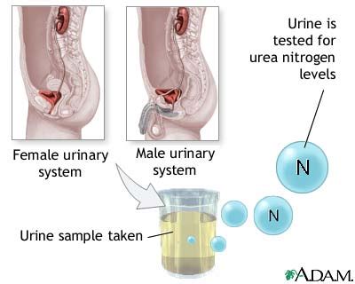 Nitrogen test: MedlinePlus Medical Encyclopedia Image