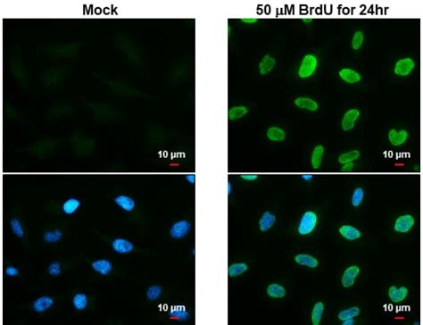 Anti-BrdU antibody (ab152095) | Abcam