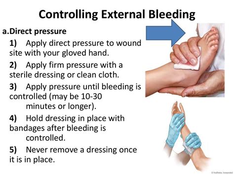 Controlling External Bleeding