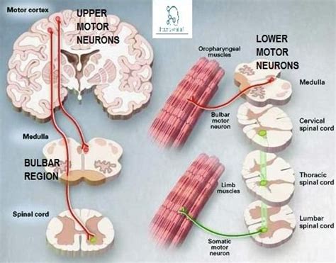 Upper Motor vs. Lower Motor Neuron Disease » How To Relief | Motor neuron, Neurons, Motor neuron ...