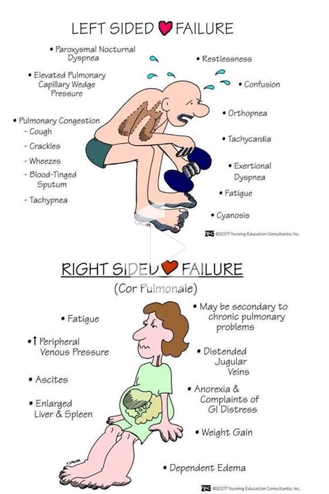 Cardiac Failure | Nursing school survival, Nursing school notes, Pharmacology nursing