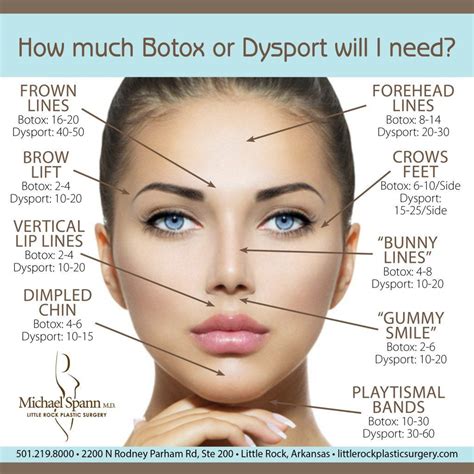 Pin on botox