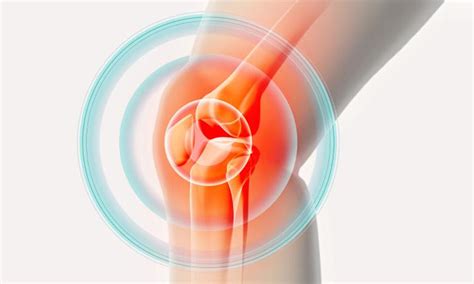 Anterior Knee Pain (Runner's Knee) - Symptoms & Causes | Parkway East Hospital