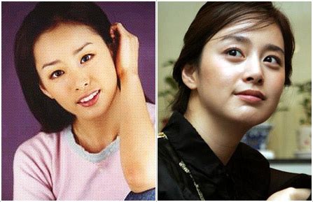 Plastic Surgery Examples: Kim Tae Hee plastic surgery before & after ...