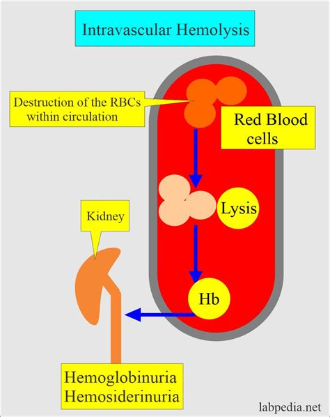 What Is B-Hemolysis at Tim Fisher blog